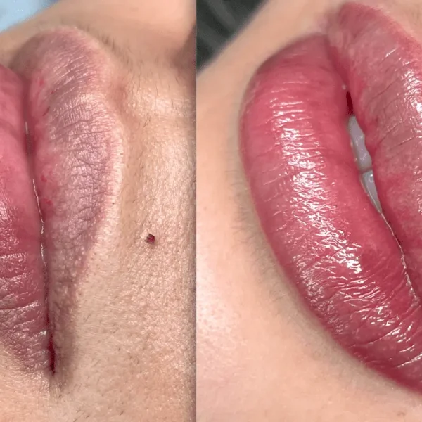 Ombre Lips Brisbane