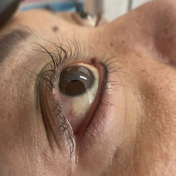 before and after bottom eyeliner tattoo