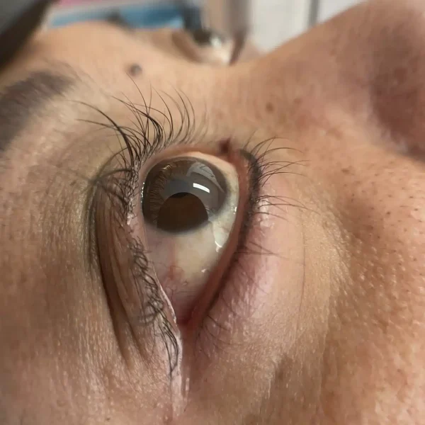 before and after bottom eyeliner tattoo