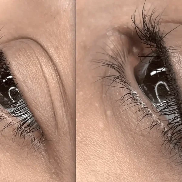 cosmetic tatooing