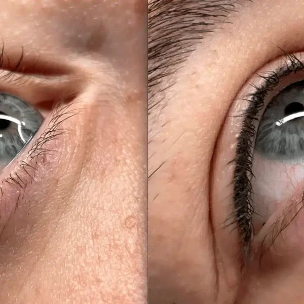 cosmetic tattoing