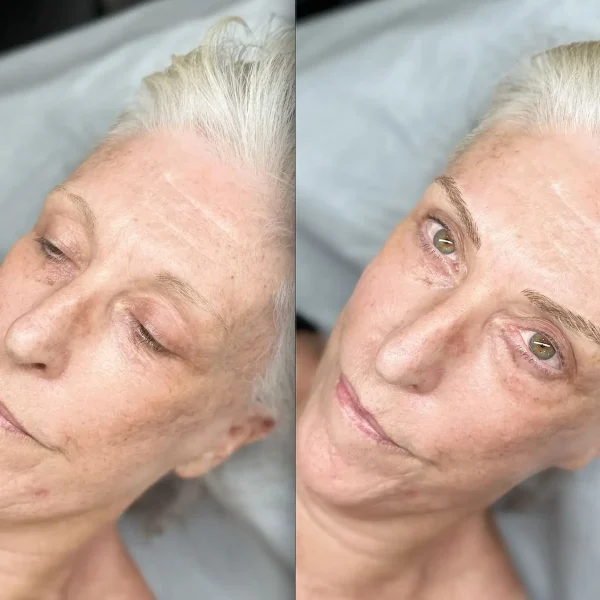 eyebrow micro blading