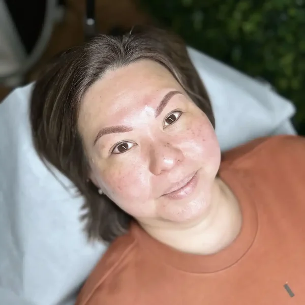 microbladinf