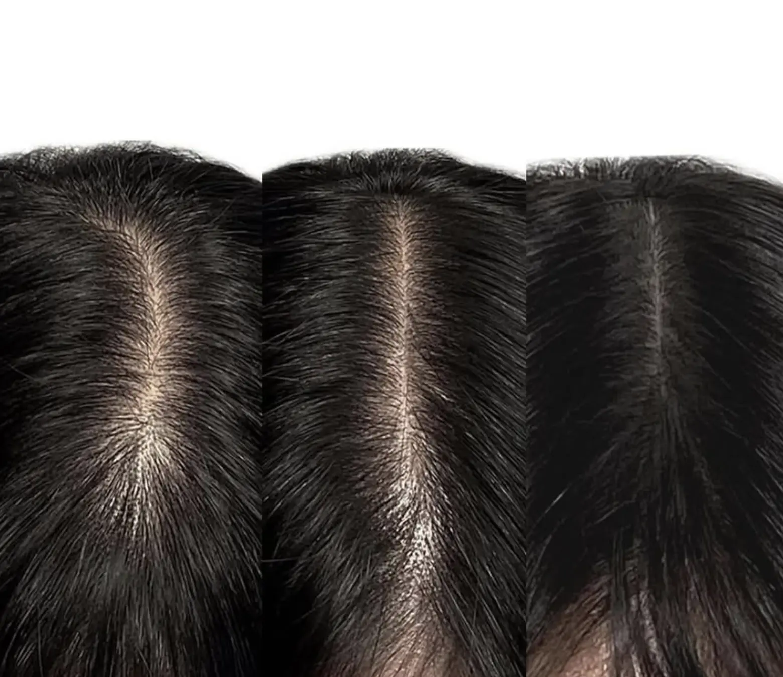 hair thinning vs hair loss