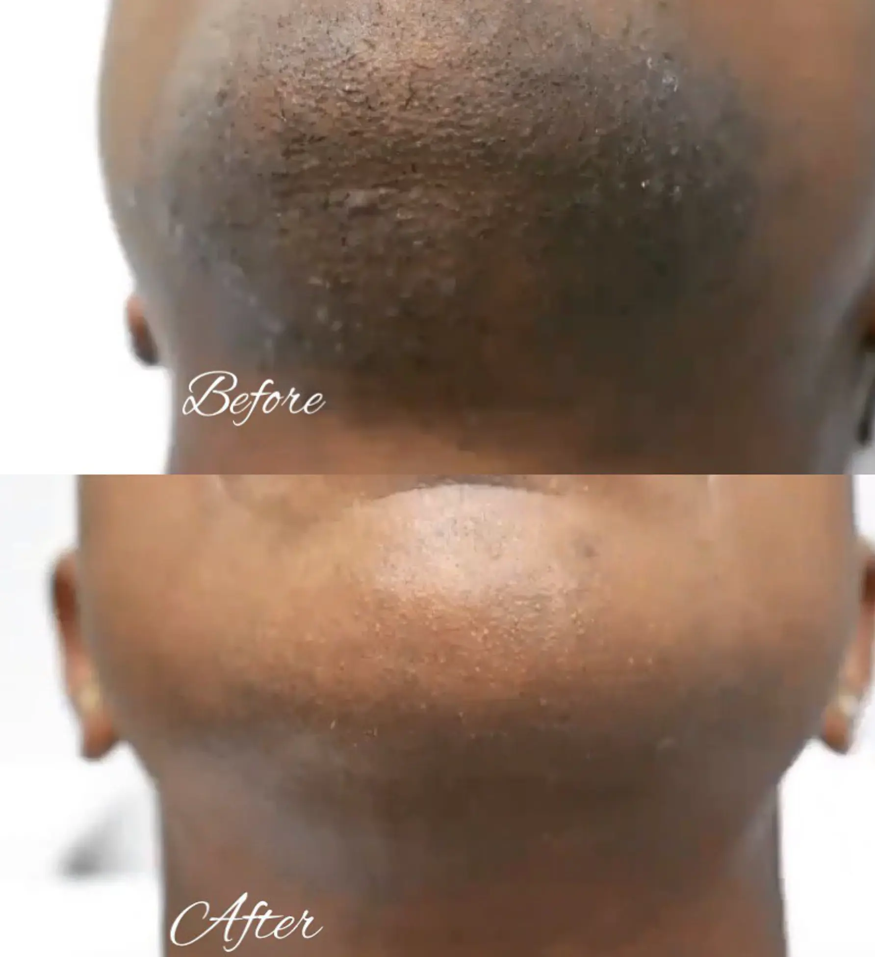 hormone that makes skin darker