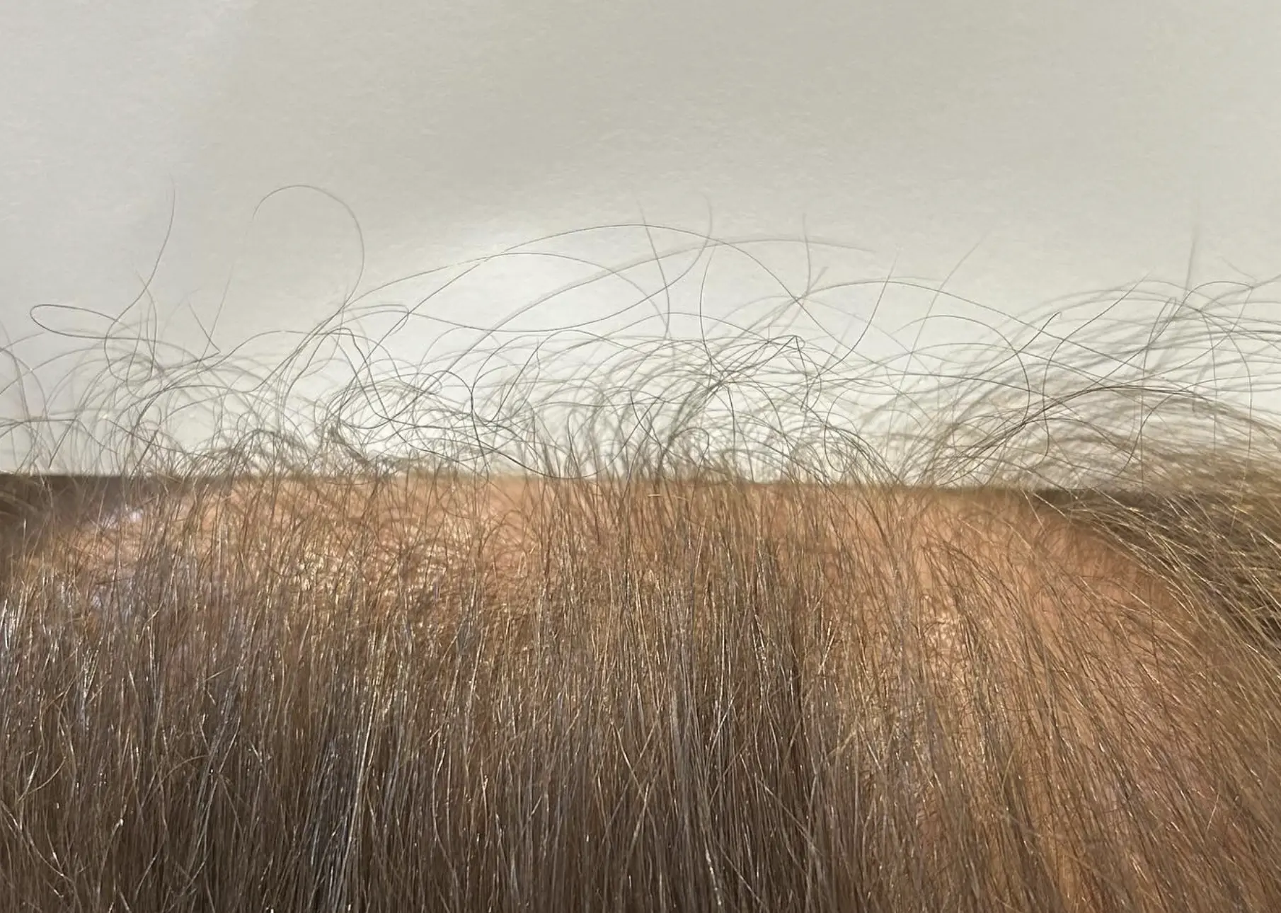 how much hair do you lose daily