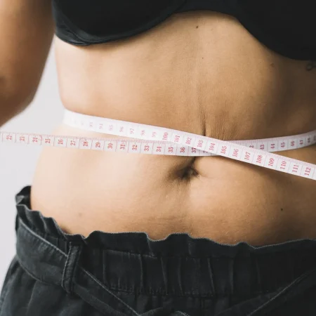 non surgical skin tightening after weight loss