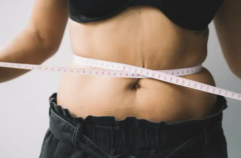 non surgical skin tightening after weight loss