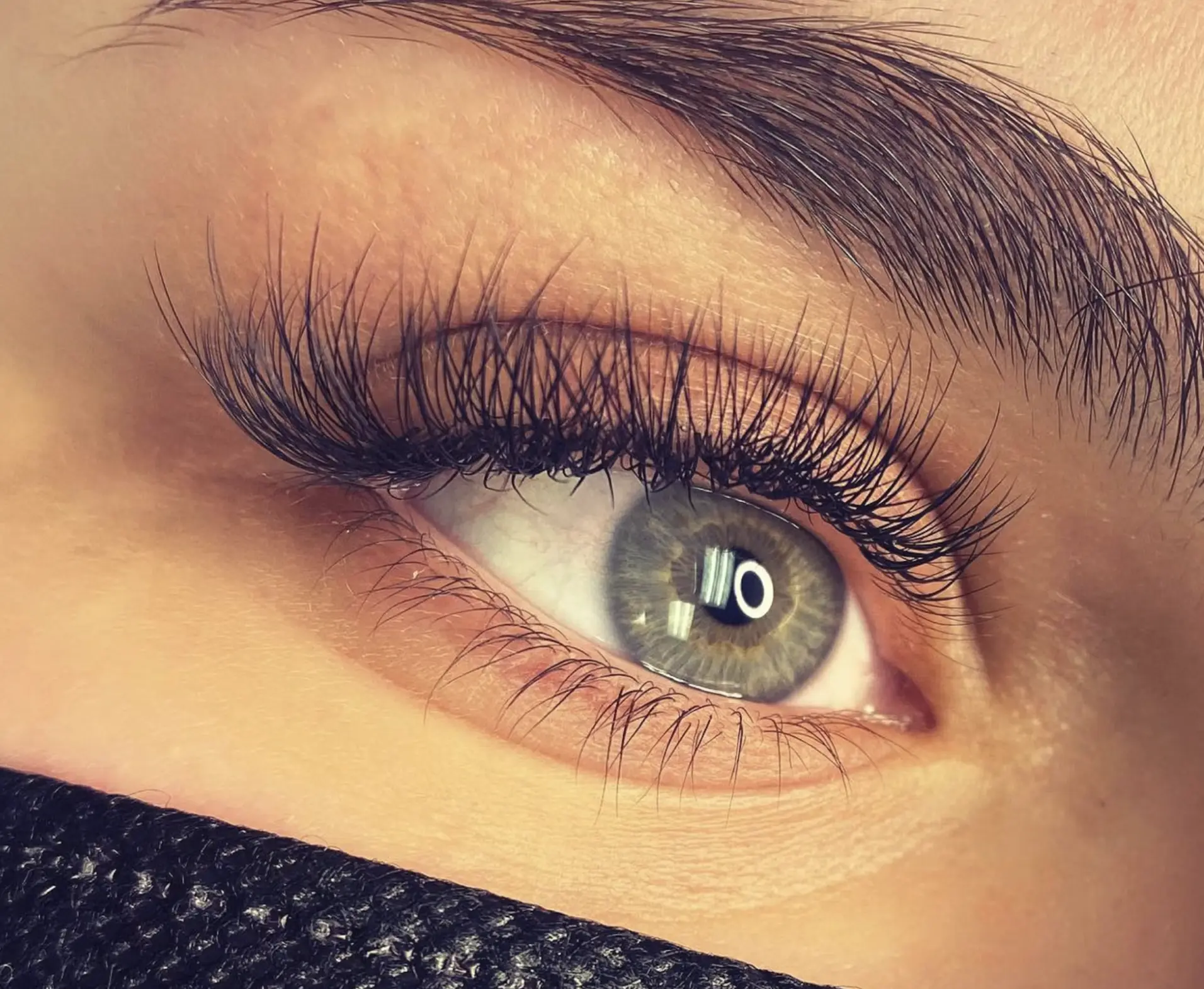 normal swelling healing timeline days