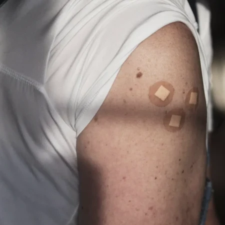 patch test for sensitive skin importance